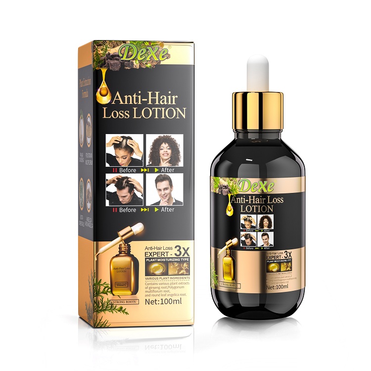 Dexe Anti-hair Loss Lotion 100ml - Black Hair Shampoo | Hair Building ...